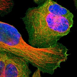 SNAP23 Antibody, Novus Biologicals:Antibodies:Primary Antibodies